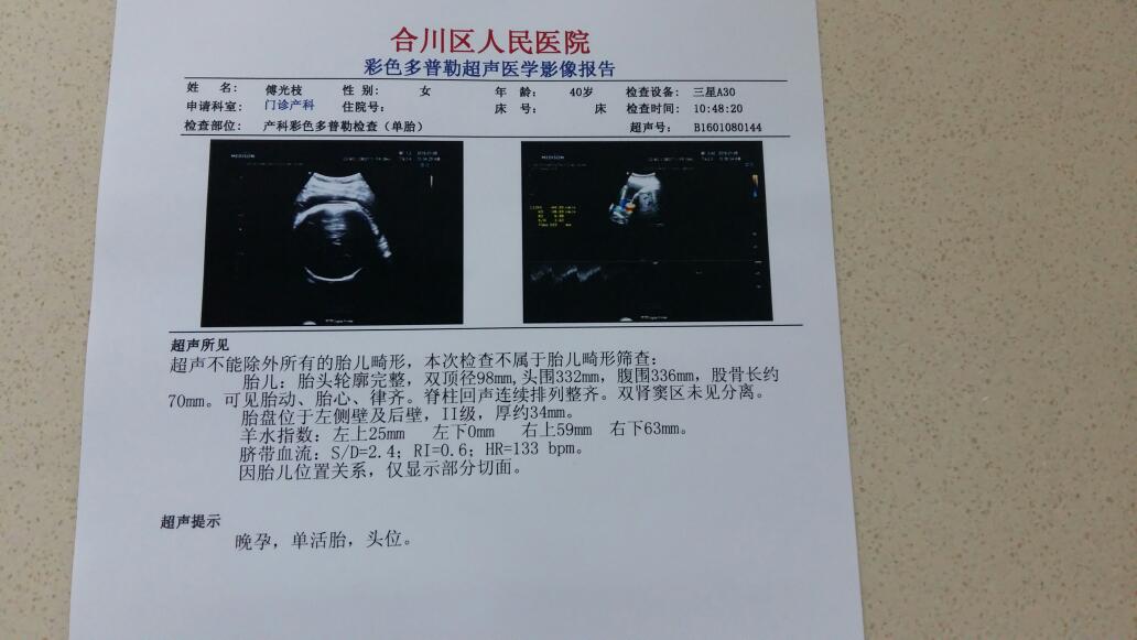 最新B超单，揭示健康秘密的关键报告