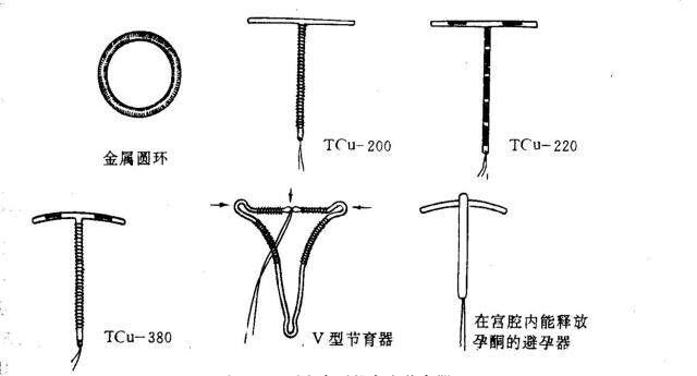 现代避孕技术探讨，节育环最新论述与观点