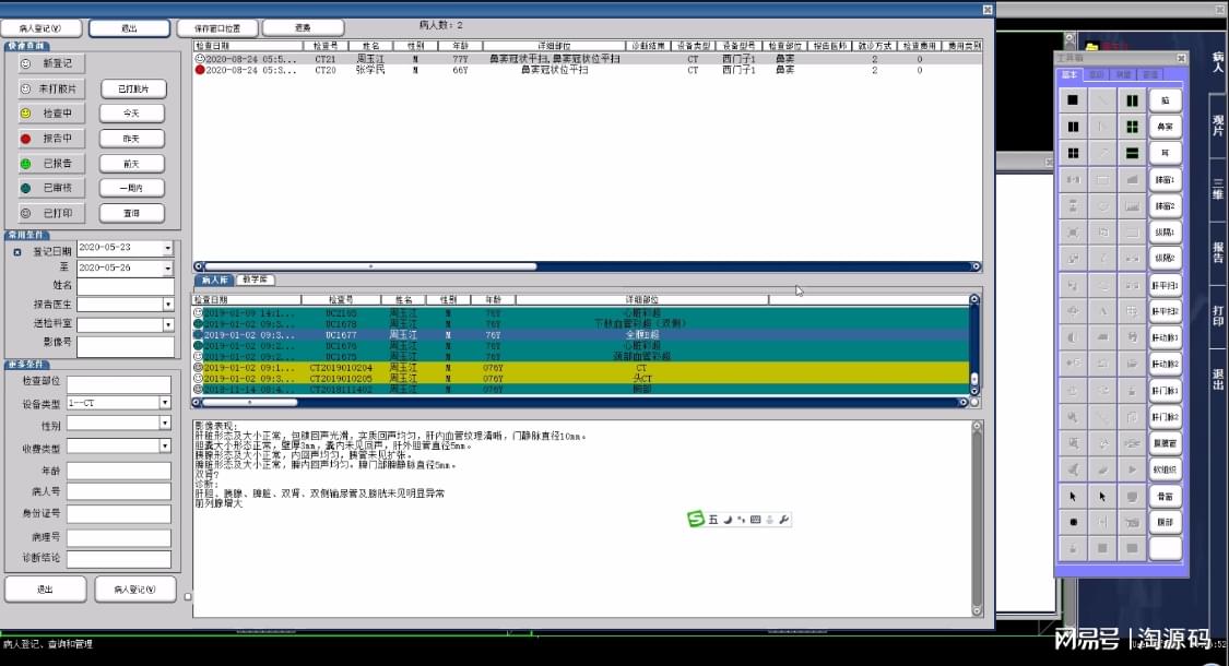 今晚9点30开鼠,系统分析方案设计_PGX10.909体验版